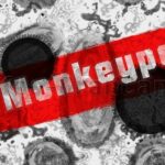 Affenpocken - Monkeypox